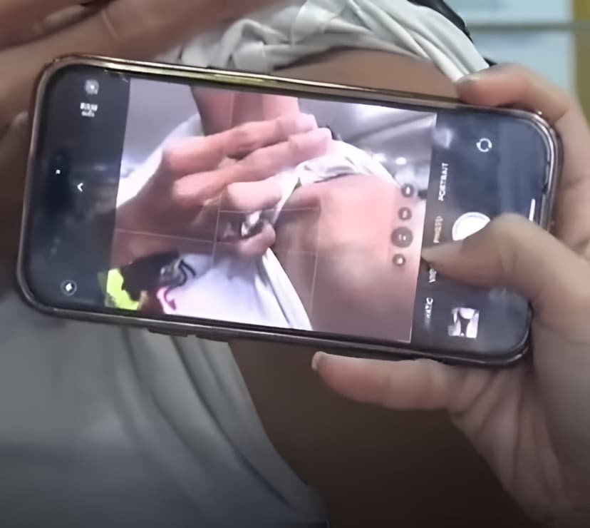 ช็อก! จ่อฟันข้อหา เบิร์ด วันว่างว่าง เอาปูนยาแนวปะหน้าคน — ภาพที่ 3