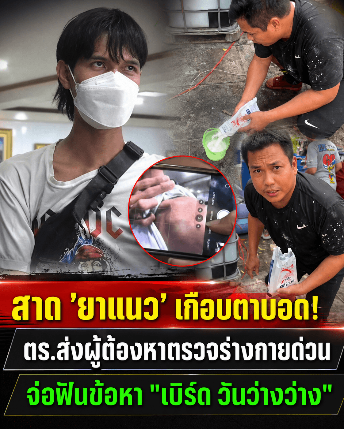 ช็อก! จ่อฟันข้อหา เบิร์ด วันว่างว่าง เอาปูนยาแนวปะหน้าคน
