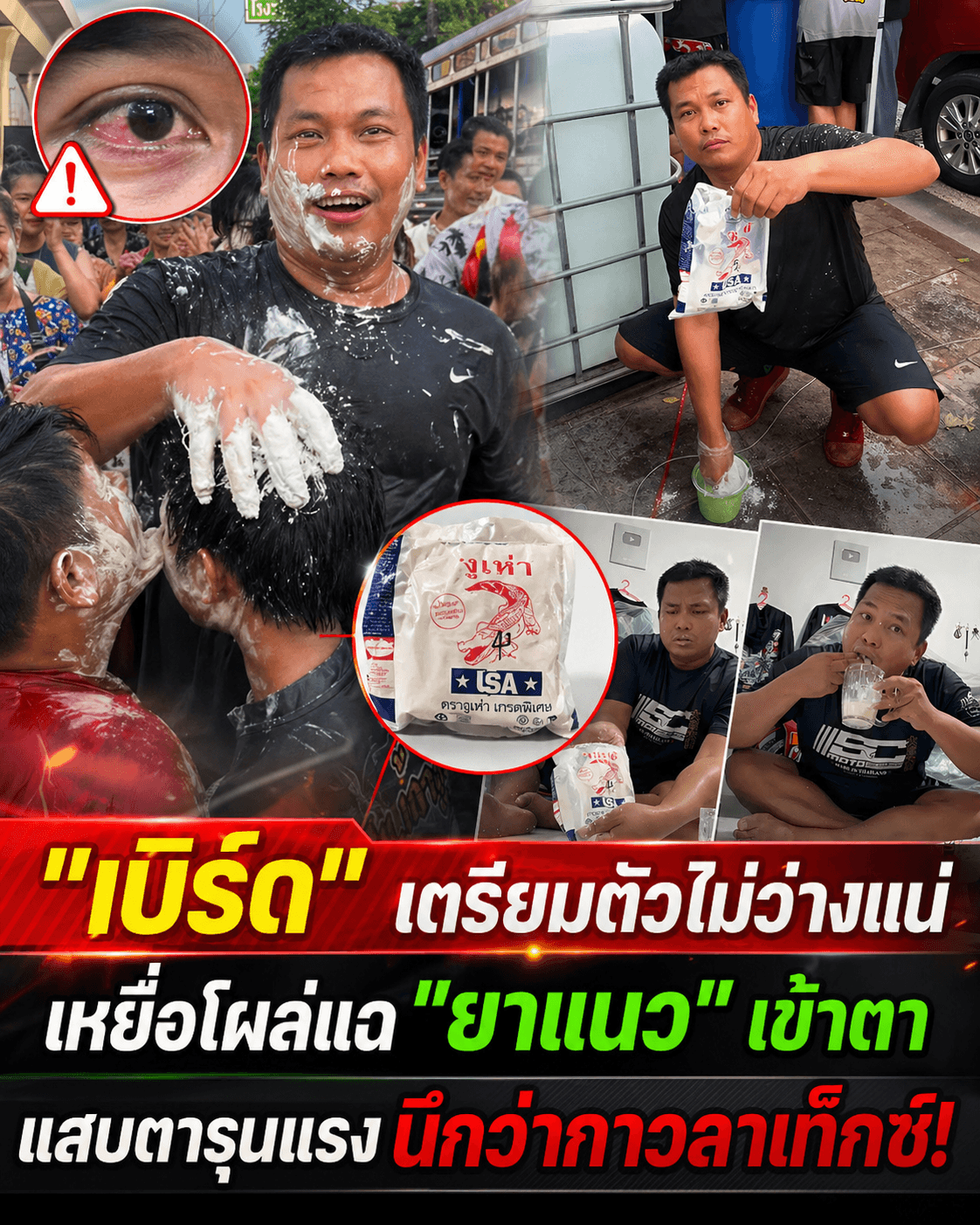 ช็อก! เหยื่อแฉ 'เบิร์ด' สาดผงตาหวิดบอด ไม่ใช่แป้งมัน?